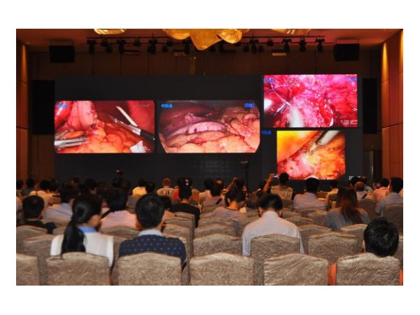 手術(shù)轉(zhuǎn)播