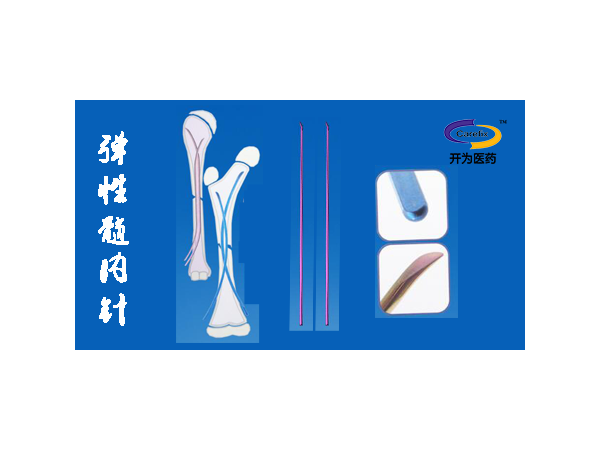 上海開為Carefix兒童骨折彈性髓內(nèi)針固定