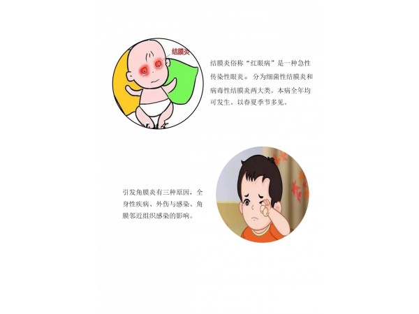 氧氟沙星滴眼液