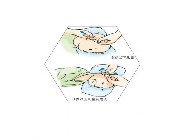 氧氟沙星滴耳液