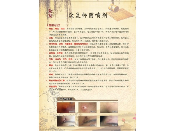 眾復(fù)抑菌噴劑