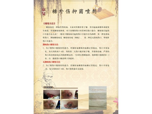 眾復(fù)唐高外抑菌噴劑