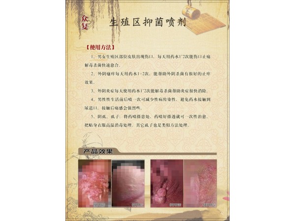 眾復生殖區(qū)抑菌噴劑