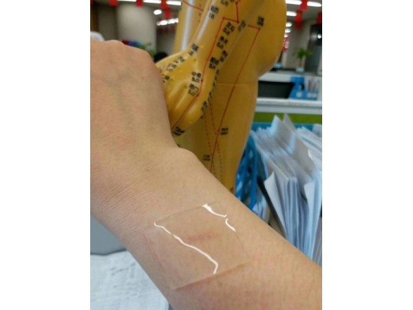 剖腹產(chǎn)專用疤痕貼 醫(yī)用修復(fù)疤痕敷料 全國(guó)招商