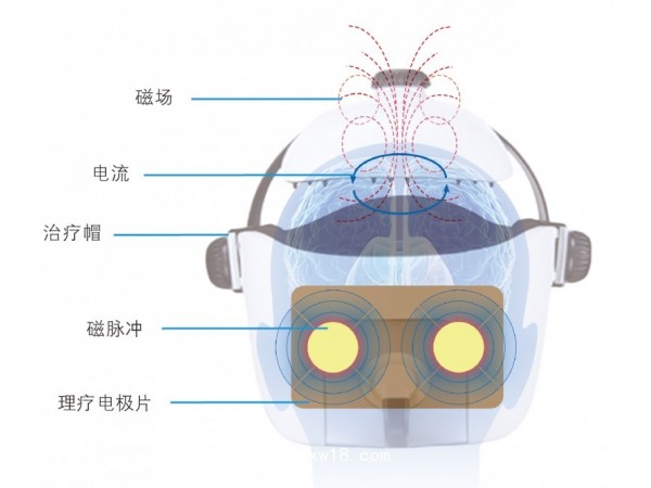 腦循環(huán)功能障礙治療儀