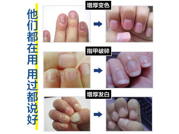 溢美高濃縮抗菌液