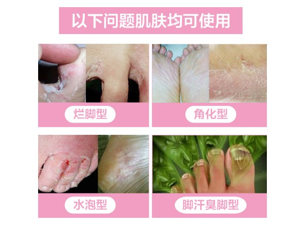 溢美濃縮抗菌液