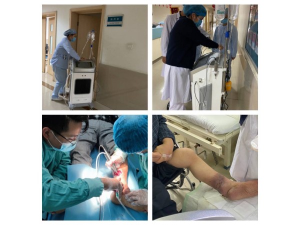 多功能清創(chuàng)機(jī)