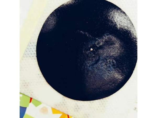 穴位貼敷治療貼（感冒）