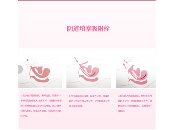 陰道填塞吸附栓  19511564058