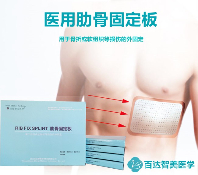 肋骨固定板1