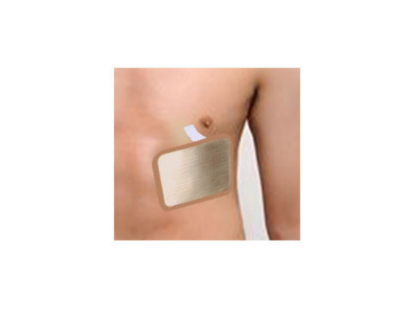 胸骨固定板（外科胸腔部骨折軟組織損傷外固定夾板廠家）百達(dá)智美醫(yī)學(xué)