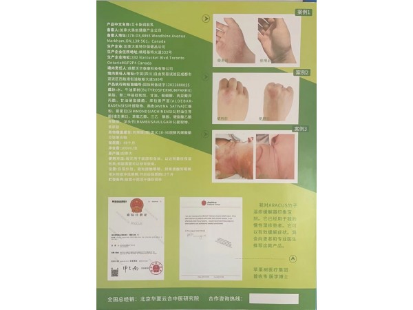 艾卡斯?jié)櫮w乳