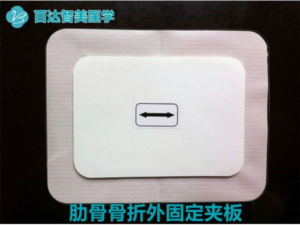 肋骨（胸骨）固定板（武漢百達(dá)智美醫(yī)學(xué)）產(chǎn)品優(yōu)勢(shì)和操作使用特點(diǎn)