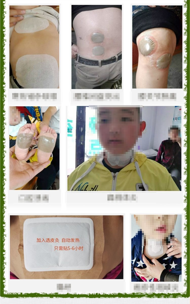 沙蒿子透皮貼定制定做貼牌代加工OEM