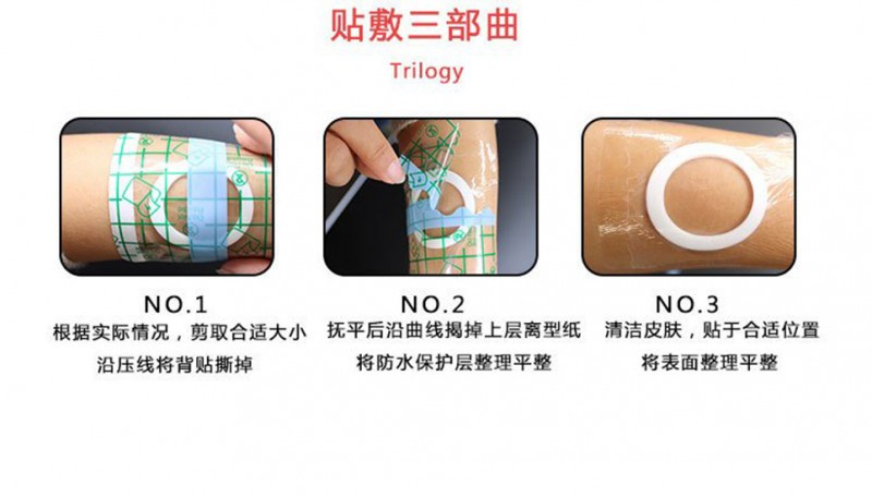 高彈透氣醫(yī)用PU防水空白貼 穴位貼oem貼牌定制醫(yī)院