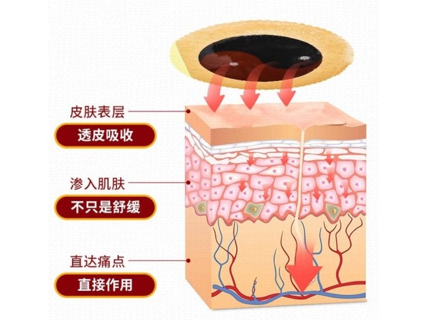 遠紅外磁療消痛貼骨質(zhì)增生帖肩周炎貼膏腰椎間盤突出腰肌勞損膏藥