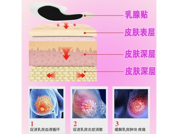 乳腺貼貼牌代加工東進(jìn)藥業(yè)婦科乳腺貼膏藥代加工