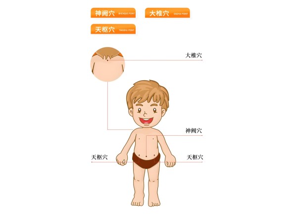 腹瀉貼代加工小兒腸脹氣貼穴位貼小兒穴位貼代加工