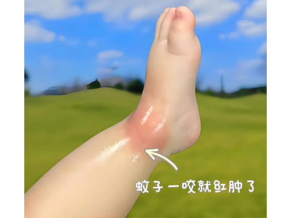 驅(qū)蚊液貼牌代工防蚊噴霧液兒童孕婦可用驅(qū)蚊液OEM貼牌廠家代工