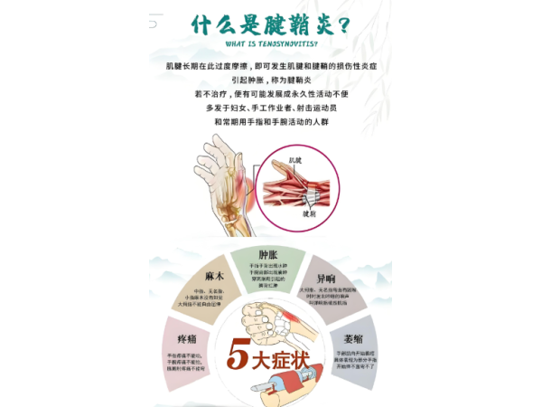 腱鞘貼OEM貼牌腱鞘炎止痛貼廠家肌腱炎貼手腕腱鞘炎貼手指腱鞘炎貼