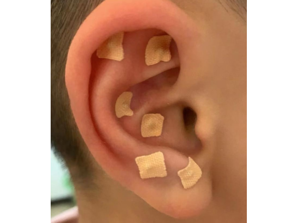耳穴貼 耳朵不適貼牌定制